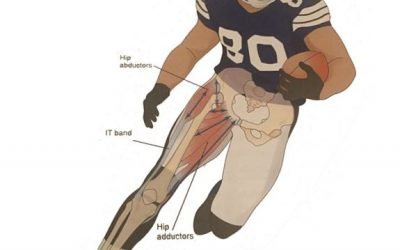 The Emerging Crisis of ACL Injuries in High School Sports